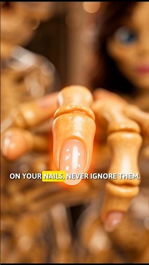 Don’t Ignore White Nail Spots #medicalfacts #whitenails #shorts