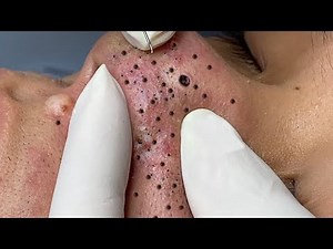 Enjoy Every Day With The Best Video Loan Nguyen Spa Official | 925