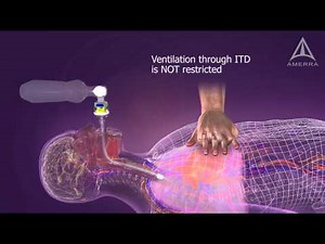 ZOLL - ResQPod - 3D Medical Animation