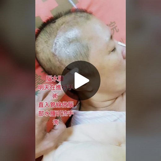 Understanding Wound Care in Medical Settings