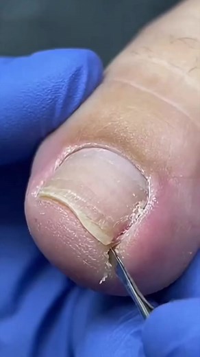 564K views · 2.2K reactions | #nail #fyp #asmr #Amazing | 3-Video | Facebook