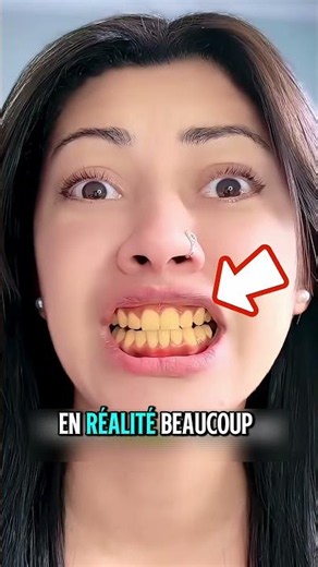 Why Your Teeth Stay Yellow Despite Brushing