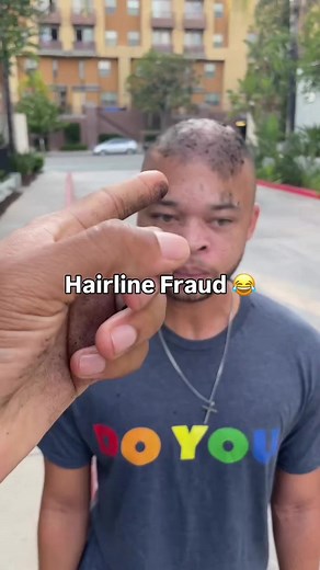 Generally promoting Baldness awareness or alopecia as the YT people say... funny thing is homie crown section been missing for 8 years and he just went bald. But yall not ready for that conversation yet huh.. In the meantime hair fibers, man weaves, and hair transplants will always be my 13 reason
