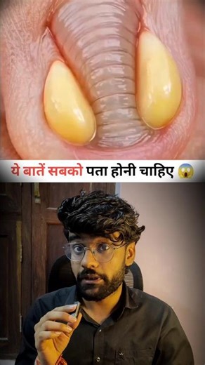 90% Log Ignore Karte Hain Nakhoon Ke Ye Signs! #healthtips #shorts