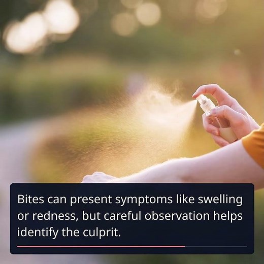 Identify Common Insect Bites: Photos & Expert Insights