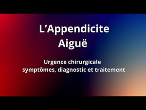 Où se situe vraiment l'appendice ? Et pourquoi c'est important