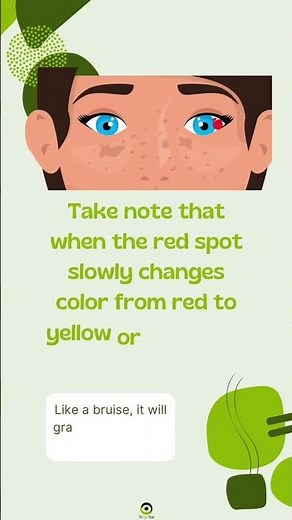 How To Treat Red Spot In The Eye