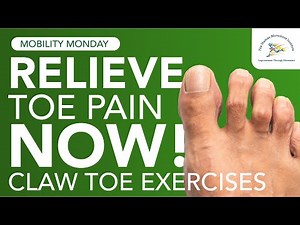 Best Exercises for Claw Toe: Relieve Toe Pain Now
