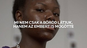 AKNÉ : okok, kezelések, termékek a La Roche-Posay-tól