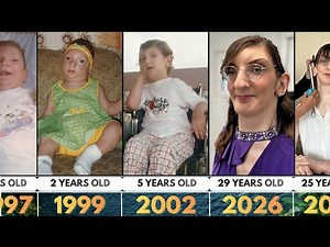 World's Tallest Woman Rumeysa Gelgi | From 29 Years Old (1997 2026) Complete Transformation