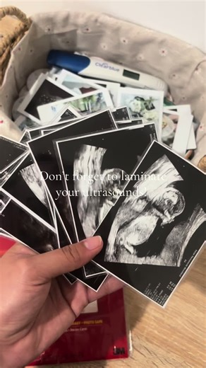 Creative Ways to Use Ultrasound Prints