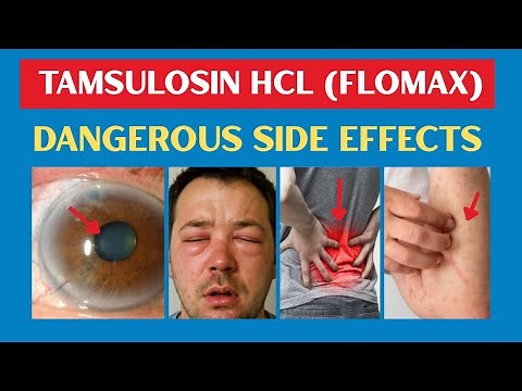 Dangerous Flomax - Tamsulosin HCL Side Effects (Doctors Don't Tell)
