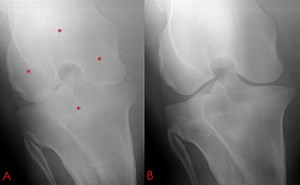 Radiography of the equine stifle (4 of 4)