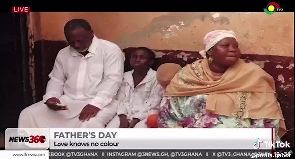 Understanding Albinism in Dark-Skinned Families