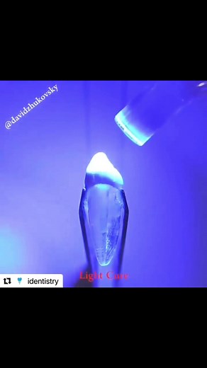 What is a dental post and when do you need it? 🔴 After a root canal is completed, if the tooth does not have enough tooth structure to keep the tooth stable, it may require a post. 🔴 It is important to know that a post does not increase the strength of the tooth, it mainly provides retention to the core(restoration/filling). . . . 🔴There are different types of posts. This is an example of a pre-fabricated post known as ParaPost Fiber Lux. . 🔴Your dentist may use this fiber pre-fab post on an