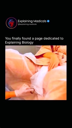 Medical | Health | Anatomy on Instagram: "Hymenoplasty is a surgical procedure that reconstructs or repairs the hymen, a thin membrane located at the vaginal opening. Medically, it is considered a cosmetic or reconstructive gynecological procedure, and it does not determine a woman’s sexual history or “virginity,” which is a social and cultural concept not a medical one. The procedure typically involves suturing remaining hymenal tissue or creating a new membrane using vaginal tissue. It is usua