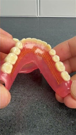 Rate this set from 1-10! 😍 Full Denture Perfection? #dentist #smiledesigndental #FullDentures