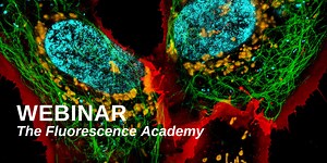 Practical considerations for fluorescent cell staining and microscopy in cancer cell biology research