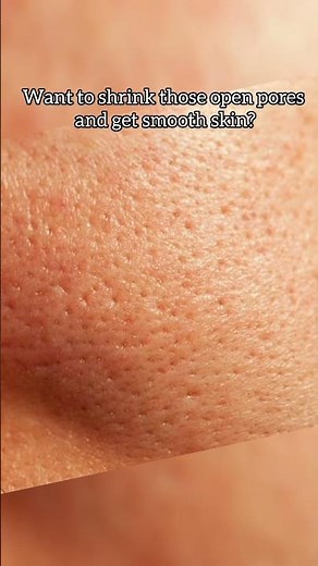 Best Serum for Open Pores | Minimalist Niacinamide 10% Review #SkincareTips #openpores