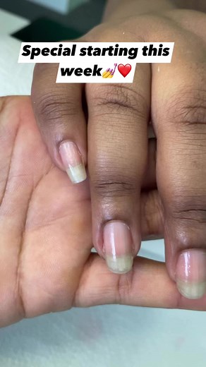 15K views · 605 reactions | To book kindly WhatsApp or Call 0677553549.. #nailartist #nailsoftheday #nailsdesign #nailsalon #nailsnailsnails #nailsart #reelsfbシ #reelschallenge #reelsviralシ #reelsfb #reelsviralシ #fypシ゚ #fypシ゚viralシ #fyp #fypシ゚viralシ2023 #fypシ゚viralシfypシ゚viralシ #fypシ゚viral #durbannorth #Durban | Marcia Snegugu Phiri | Facebook