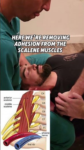 Neck Pain FIXED at the Nerve Roots?! 💥