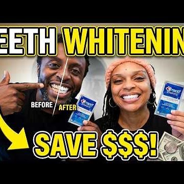 We Tried Teeth Whitening at Home (Honest Couple Results)
