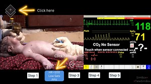 SimBox: A Newborn Resuscitation Interactive Video Simulation