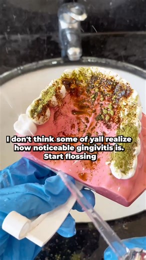 🎄❄️ Christmas Sale Sale Is Live ❄️🎄 Get 55% OFF on Top-Rated Pick Plus FREE 4 Gifts. We Spent the Last Three Months Testing the 24 Water Flossers Devices to Find the Best 5 Water Flossers in 2025. We rated the best five options based on👇 ✅ Best Results ✅ Safe for At-Home Use ✅ Cost Effective ✅ 100% Money Back | Water Flosser