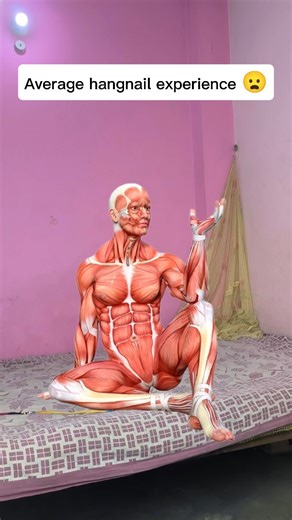 “Hangnail Pain Be Like 😭💀 #relatable” . . . . . . . #instagram #viral #trending #meme #relatable #funny #comedy #hangnail #pain #funnyshorts #viralshorts #fyp #instadaily #memeshorts | Amrianshu Nagar