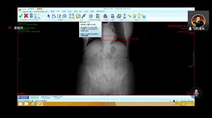 PACS高级应用培训