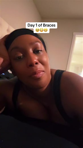 Transforming My Smile at 36: Day 1 with Braces