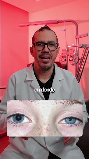 La anisocoria ⚠️