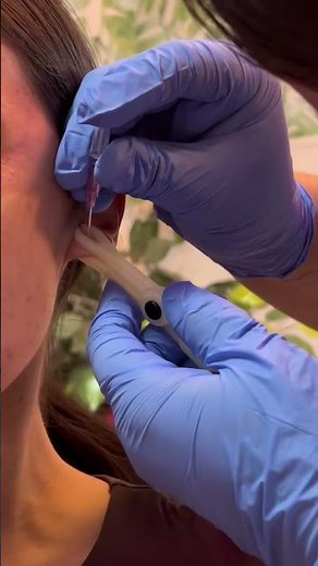 Young Woman Gets Her Ears Pierced With A Needle For The First Time