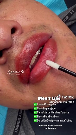 Correccion de labios oscuros - Men’s Lips