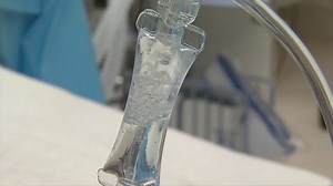 Your Health: How ‘lung washing’ helps patients breathe