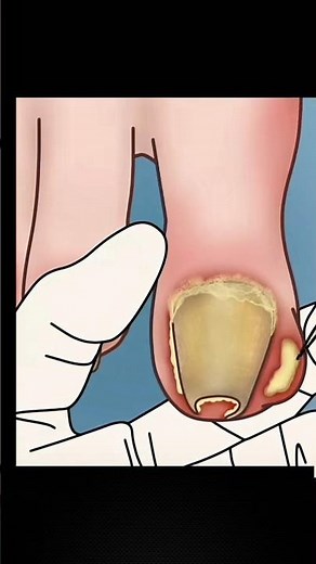 ASMR Toe Cleaning#animation #cleaning #satisfying #foryou #shortsasmr #asmr #asmrsounds #viral