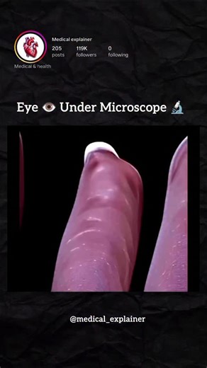 Medical explainer on Instagram: "Eye 👁️ Under Microscope 🔬"