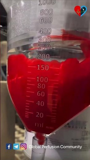 Cardiovascular perfusion technology 🫀#cardiachealth #perfusion