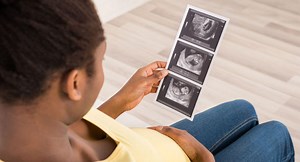 Are ultrasound scans safe?