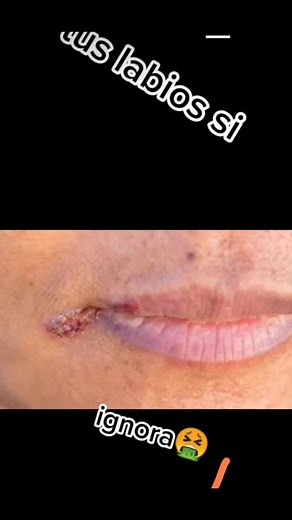 Transform Your Lips with Glossy Red Lipstick Techniques