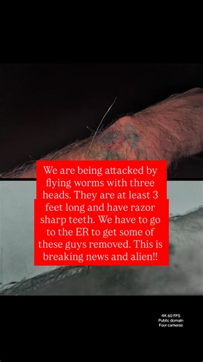 Brian Ladd on Instagram: "We are currently being attacked by flying worms. They have to wear a sharp teeth. Some of them are very long. I have to go to the ER to get some removed. They are growing quickly and should spread around the world soon. We did let the CDC know however, I don’t think they care because they are alien. I’m being attacked by 3 foot long flying Worms with multiple heads, sharp teeth and bodies stronger than steel! We have been documented alien life in St. Louis County Florid
