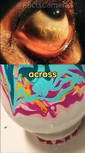 👉 The Terrifying Parasite That Moves Inside Your Eye! 😱 #facts