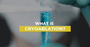 This fascinating medical advancement is used to destroy the malignant cell while also gathering important information. Having access to good information will allow this form of therapy to then destroy the cancer that’s affecting the body. You may be wondering “what exactly is cryoablation?” Well, it’s a form of immunotherapy that involves freezing a tumor directly with a thin needle. It works best when used for early stage cancer and is useful with immune-enhancing measures to reduce the risk of