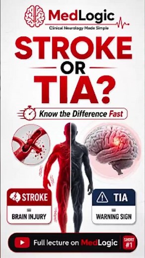 TIA vs Stroke: Why Your Doctor Won't Call It 'Just' a TIA #health #stroke