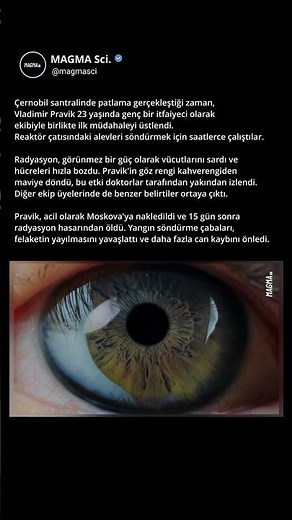 Radyasyonun İzleri | Chernobyl Kahramanı Vladimir Pravik #shorts