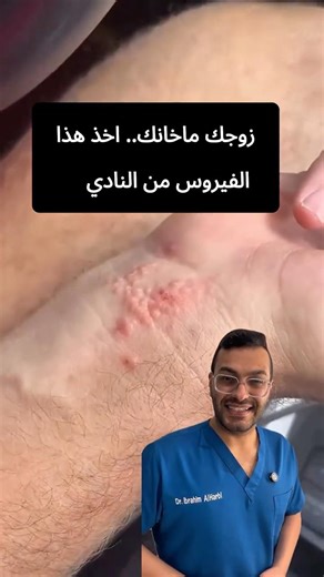 زوجك ماخانك اخذ هذا الفيروس من النادي