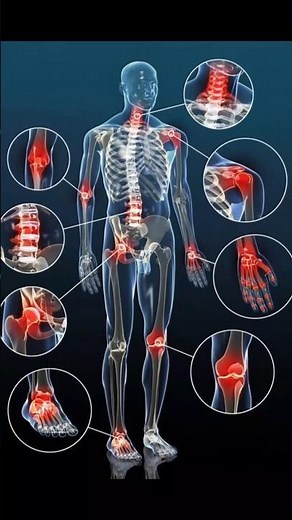 5 Amazing Health Benefits Of Cherry #facts #easynutrition #weightlosstips #weightloss #healthyfood