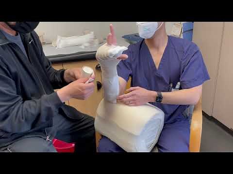 Ulnar Gutter Splint Application