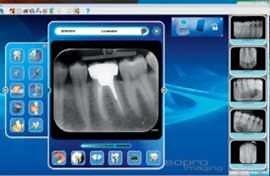 PSPix2 x ray scanner