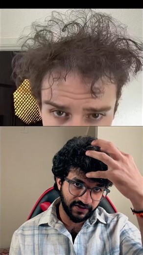 Mi hair DRY ga enduku undhi ? #shorts